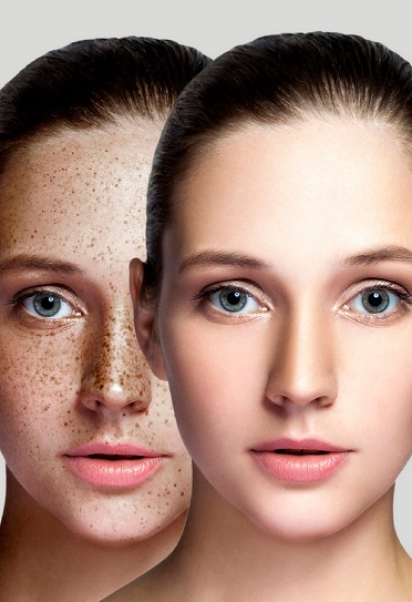 Best Skin Treatment Services