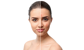 Skin Treatment | Skin Care Clinical Services | Skin care - Anoos