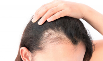 Hair Treatments | Hair Clinical Services | Anoos Hair Experts