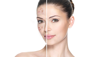 Skin Treatment | Skin Care Clinical Services | Skin care - Anoos
