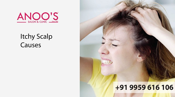 What are the causes for itchy scalp?