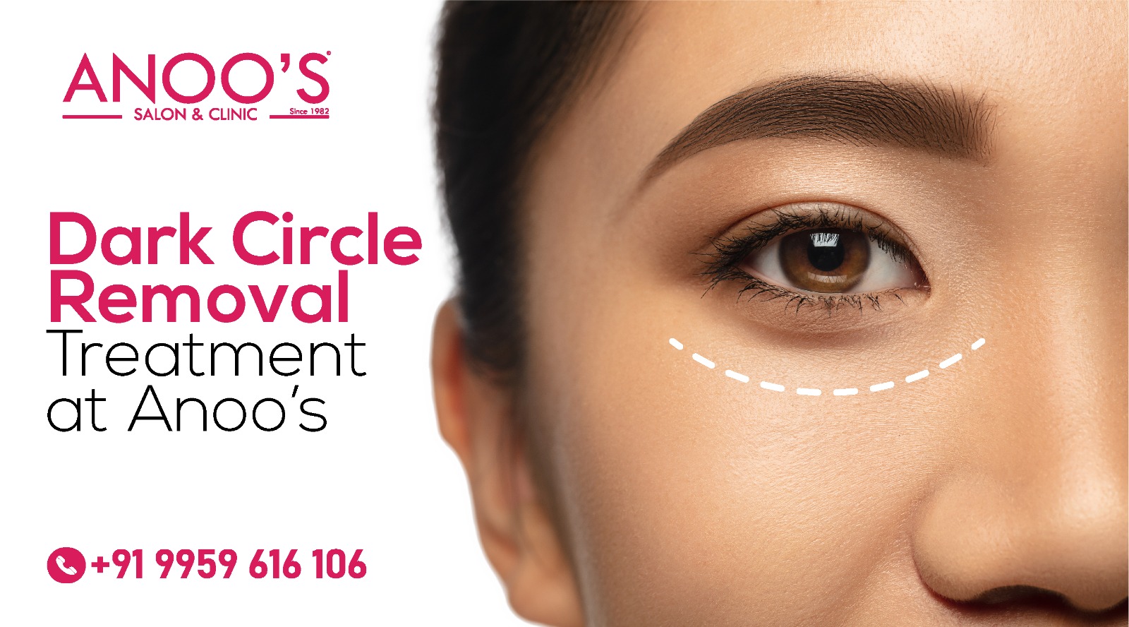 Unmasking the Truth: Chemical Peels and Other Dark Circle Treatments Compared | Anoos