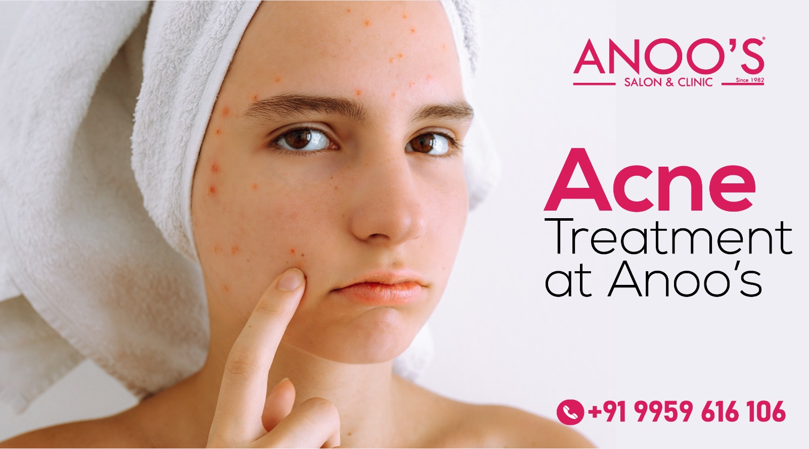 Say Goodbye to Acne Scars with Anoos Advanced Acne Removal Treatment | Anoos