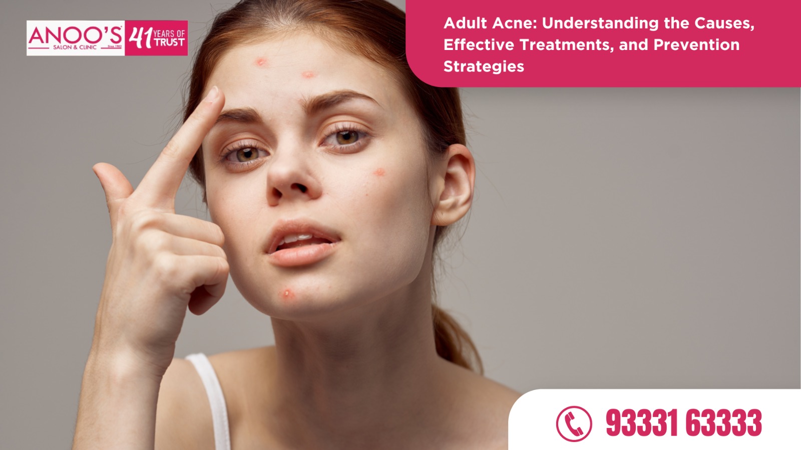 Adult Acne: Understanding the Causes, Effective Acne removal Treatments, and Prevention Strategies