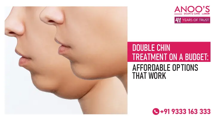 Double Chin Treatment on a Budget: Affordable Options That Work