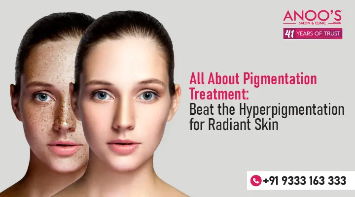 All About Pigmentation Treatment: Beat the Hyperpigmentation for Radiant Skin