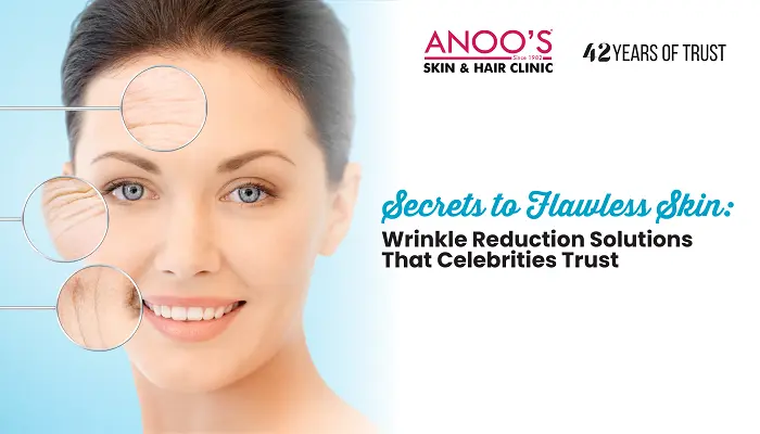 Secrets to Flawless Skin: Wrinkle Reduction Solutions That Celebrities Trust