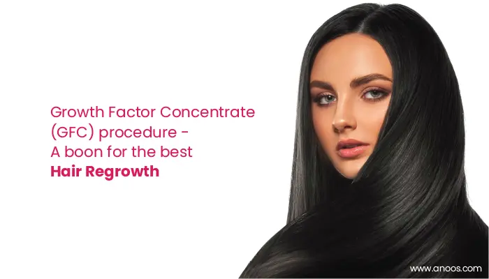 Growth Factor Concentrate (GFC) procedure – A boon for the best Hair Regrowth