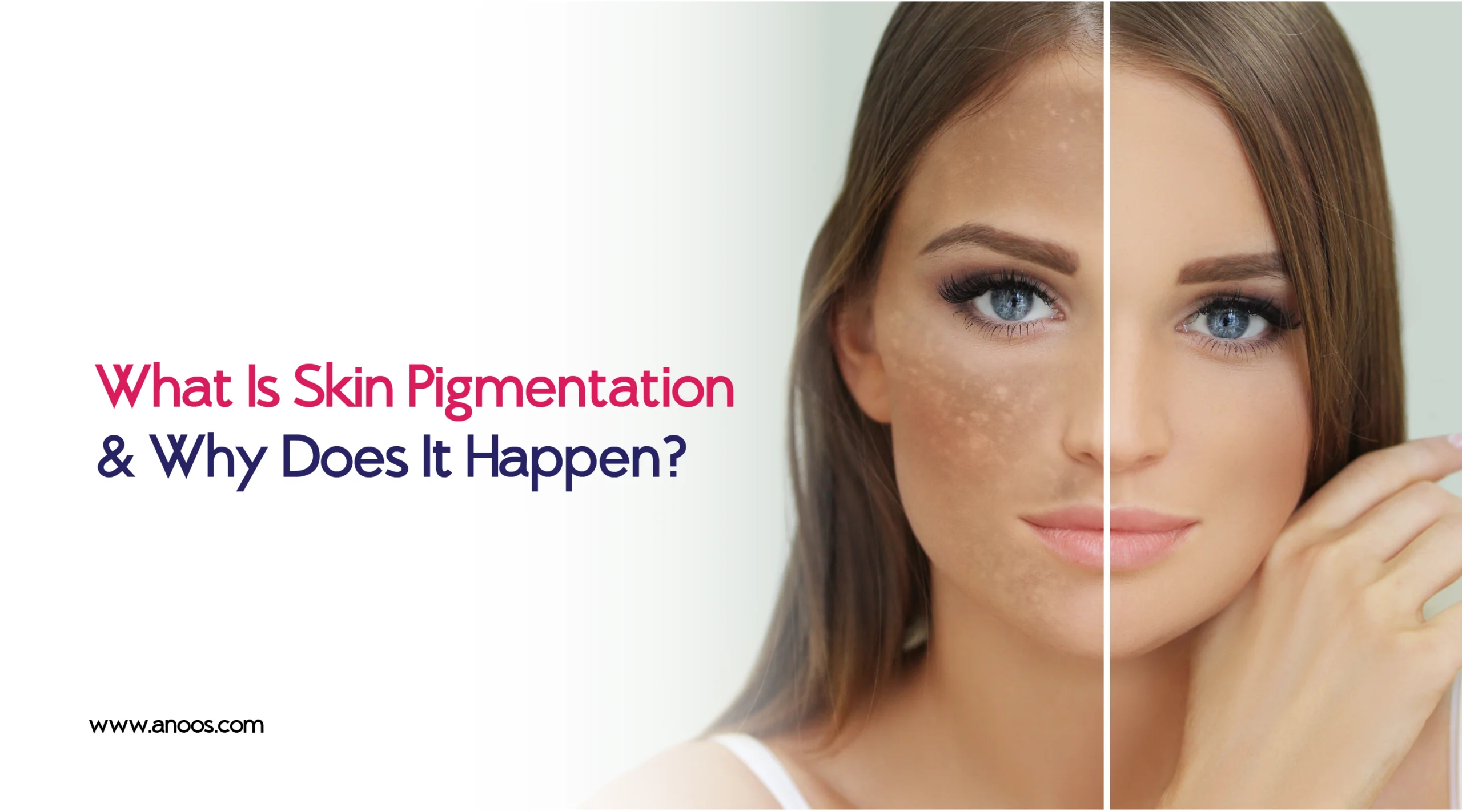 What Is Skin Pigmentation & Why Does It Happen?