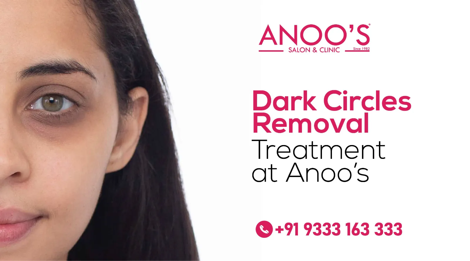 Say Goodbye to  Dark circles with Specialized Eye-Peels and Electroporation