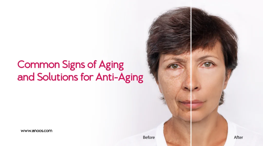 Common Signs of Aging